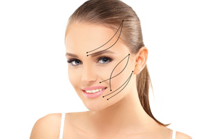 Thread Lift