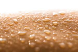 Hyperhidrosis