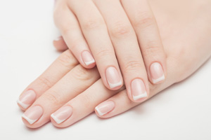 Onychomycosis