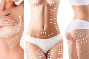 Total Body Reshape
